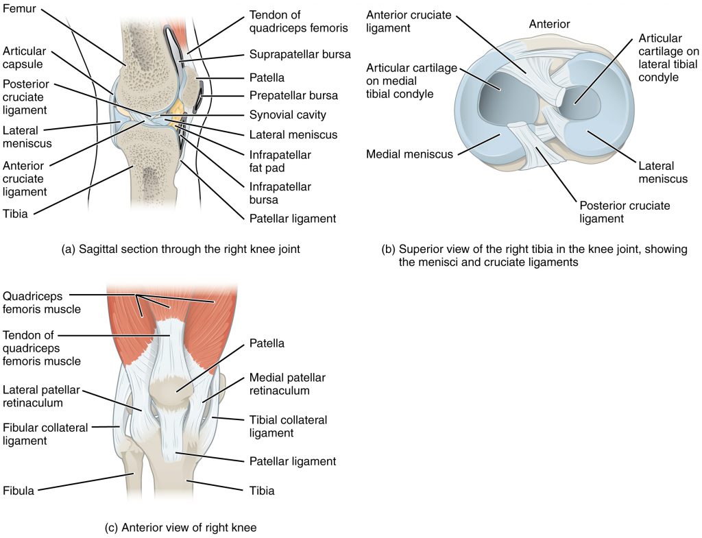 Musculoskeletal Joints and Tendons, 6.6 Knee : Case 6.6.12 Lateral side  knee